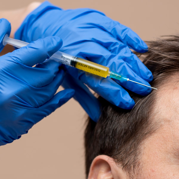 prp capilar Clínica de Medicina Estética en Valencia (Alzira) con los mejores profesionales y los más avanzados tratamientos.